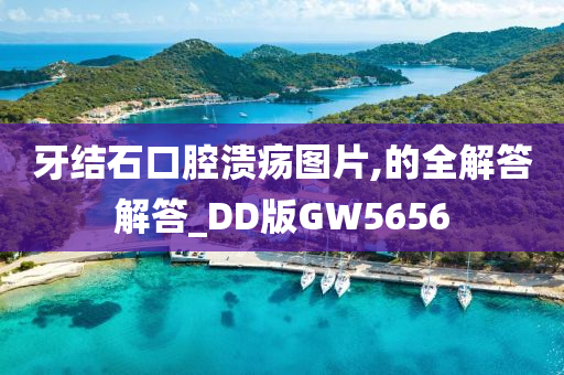 牙结石口腔溃疡图片,的全解答解答_DD版GW5656